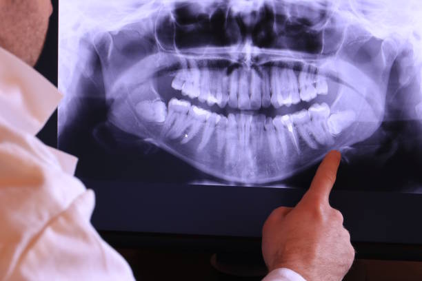 Best Pediatric Emergency Dentist in Oak Grove, LA