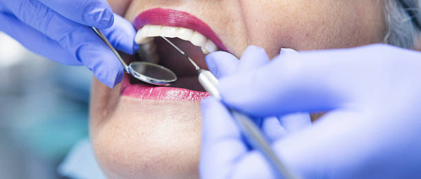 Best Pediatric Emergency Dentist in Oak Grove, LA